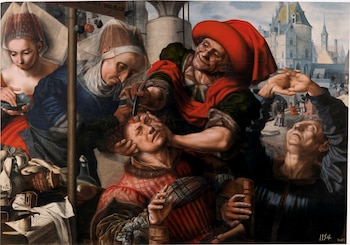 "El cirujano o Extracción de la piedra de la locura", de Jan Sanders van Hemessen.