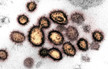 El coronavirus es visto bajo
