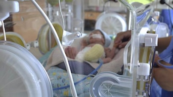 Nacimiento prematuro (MSP Uruguay)
