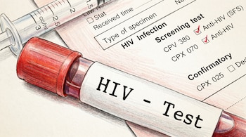 Un tubo de ensayo rojo etiquetado como HIV - Test junto a una jeringa y un formulario médico con opciones de prueba Anti-HIV marcadas.