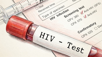 El 30 % de los nuevos diagnósticos de VIH se registra en personas que nunca se hicieron el test