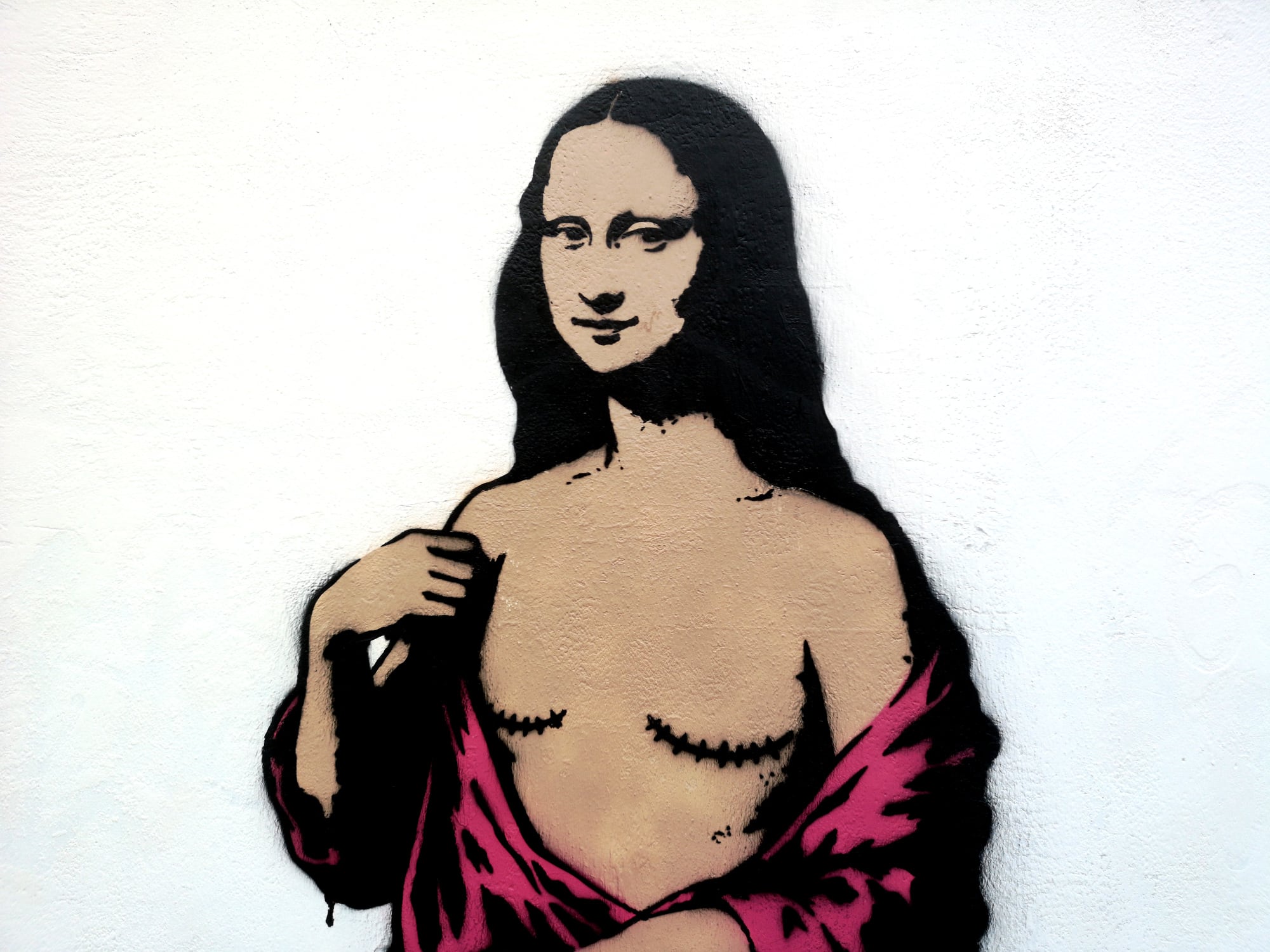 La Mona Lisa con cicatrices de mastectomía de Alexandro Palombo (Cedida)