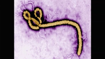 Vista microscópica del mortal virus del Ébola