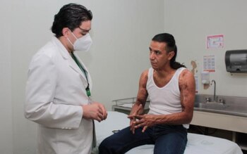 oscar quemado imss mexico 2