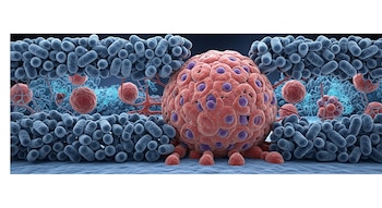 El microbioma tumoral incide en