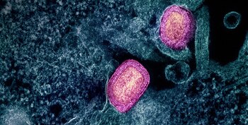 Dos partículas del virus mpox,