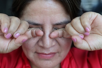 La conjuntivitis viral se transmite