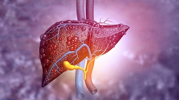 Análisis de sangre revela enfermedad