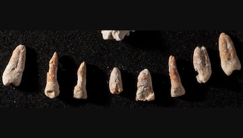 16/03/2021 Incrustaciones dentales de jade