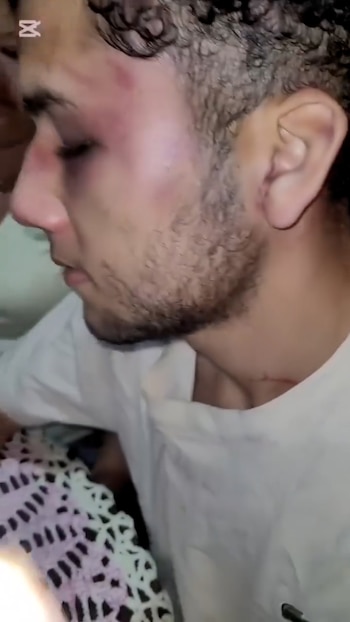 Las lesiones que sufrió en