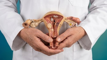 5 aspectos clave para entender el cambio de nombre del Síndrome de Ovario Poliquístico (SOP) a Síndrome Ovárico Metabólico Poliendocrino (SOMP)