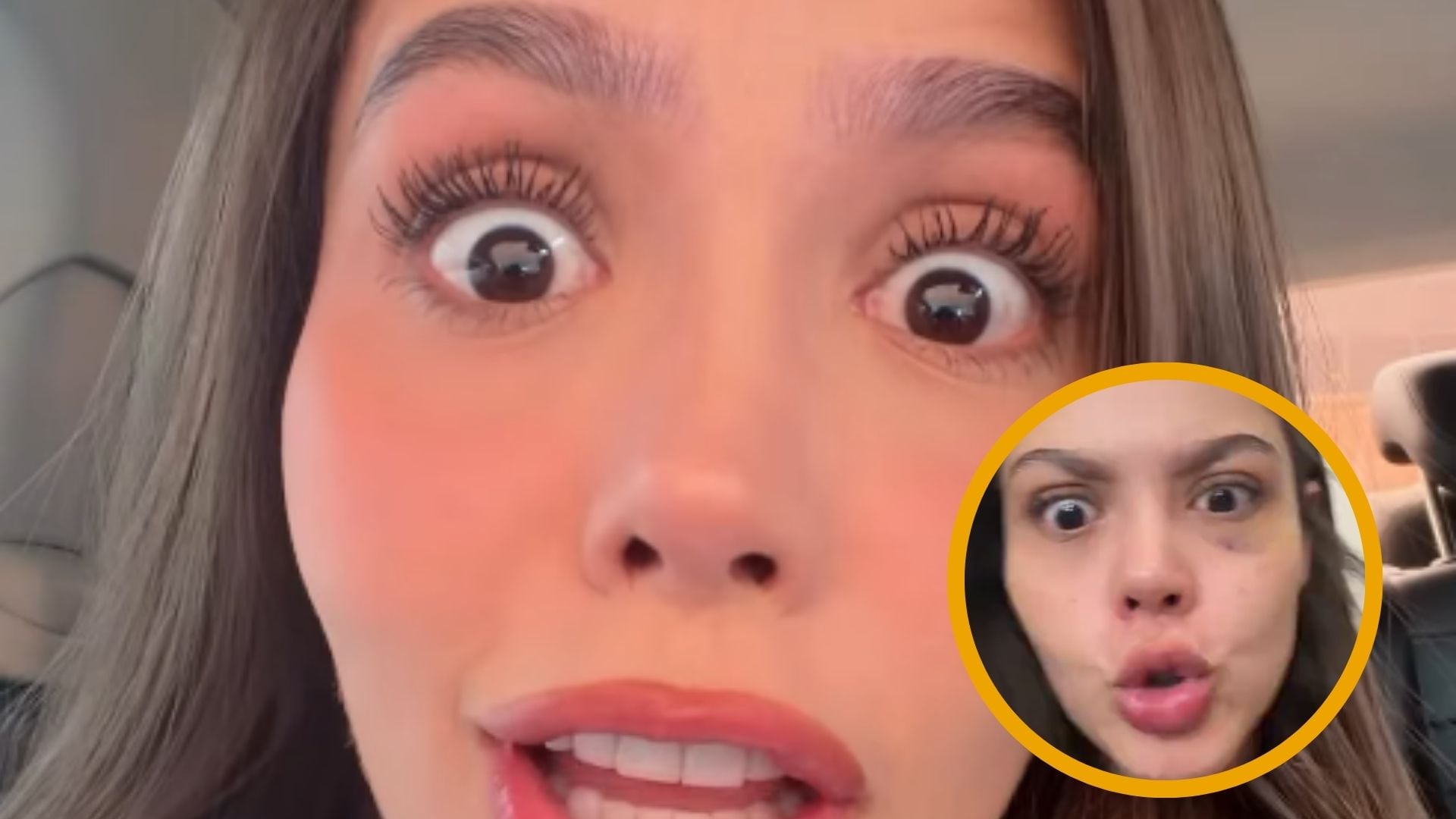 La influenciadora Alejandra Urrea apareció en redes con un golpe en el ojo: “La piroba me lo metió”