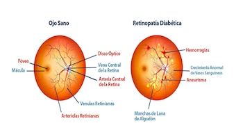 gotas oftálmicas retinopatía diabética INB UNAM avance (Foto: INB)