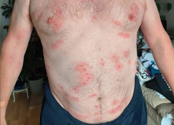 Richard, amigo de Powell, lo