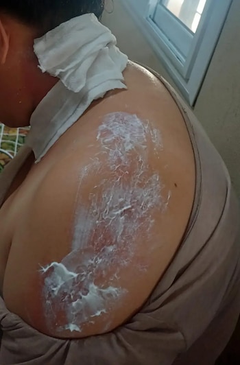 La víctima, de 25 años, recibió asistencia médica luego del presunto ataque (Fuente: Diario Chaco)