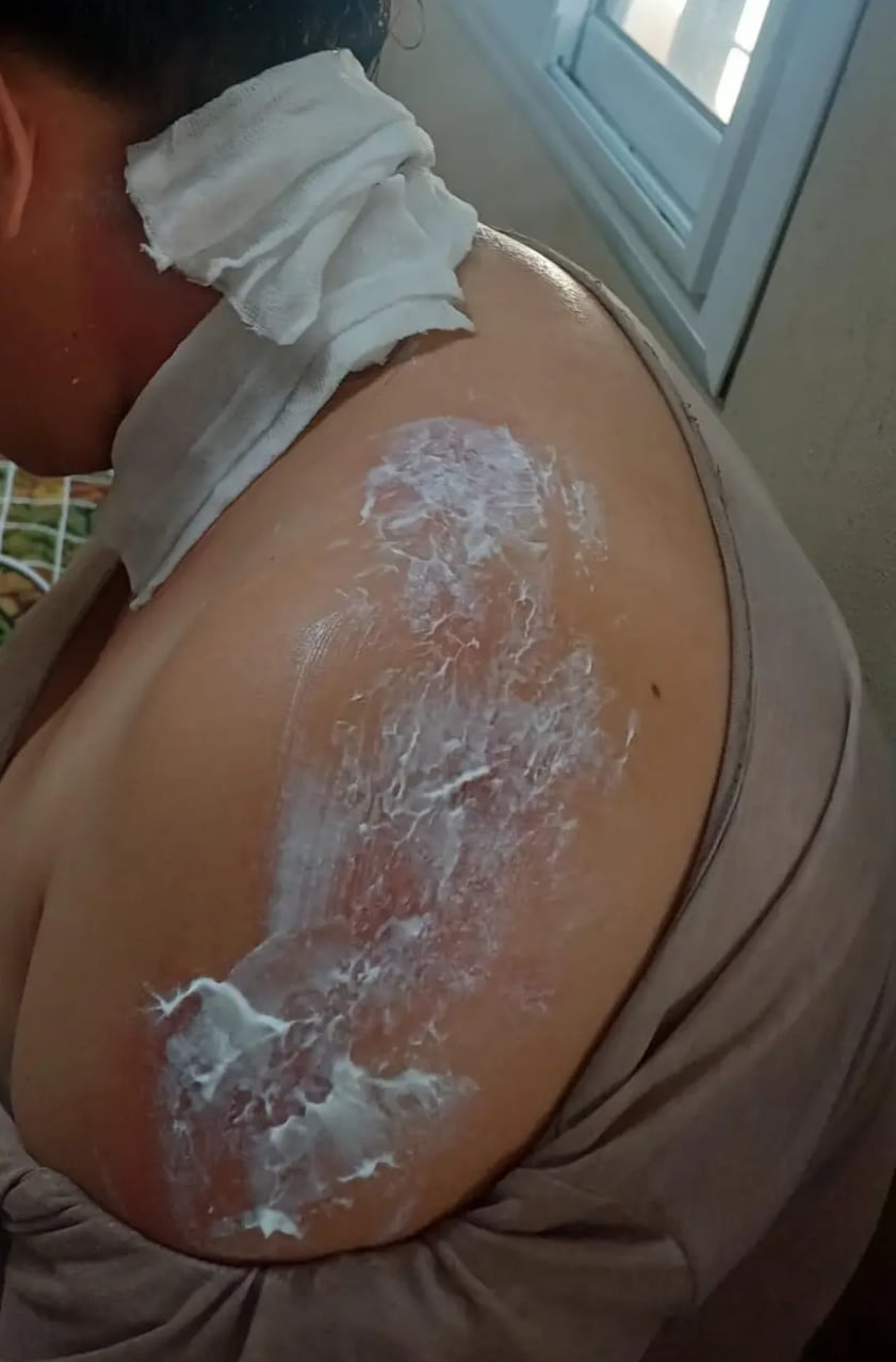 La víctima, de 25 años, recibió asistencia médica luego del presunto ataque (Fuente: Diario Chaco)