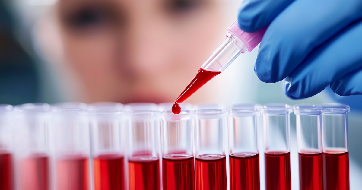 RIESGO OCULTO: Más allá del colesterol, nuevos marcadores revelan el verdadero peligro cardiovascular