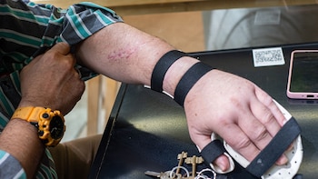 "Se me cortó un tendón