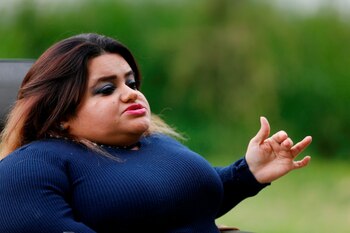 En su niñez tuvo fracturados