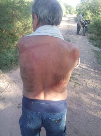 Amato denunciò haber sido agredido