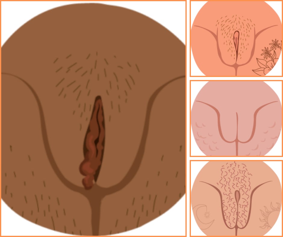 Tipos de vulva según la forma de los labios vaginales (Healthline)