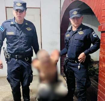 El hombre con antecedentes de trastornos mentales permanece bajo custodia policial mientras se esclarecen los hechos (Cortesía: PNC).