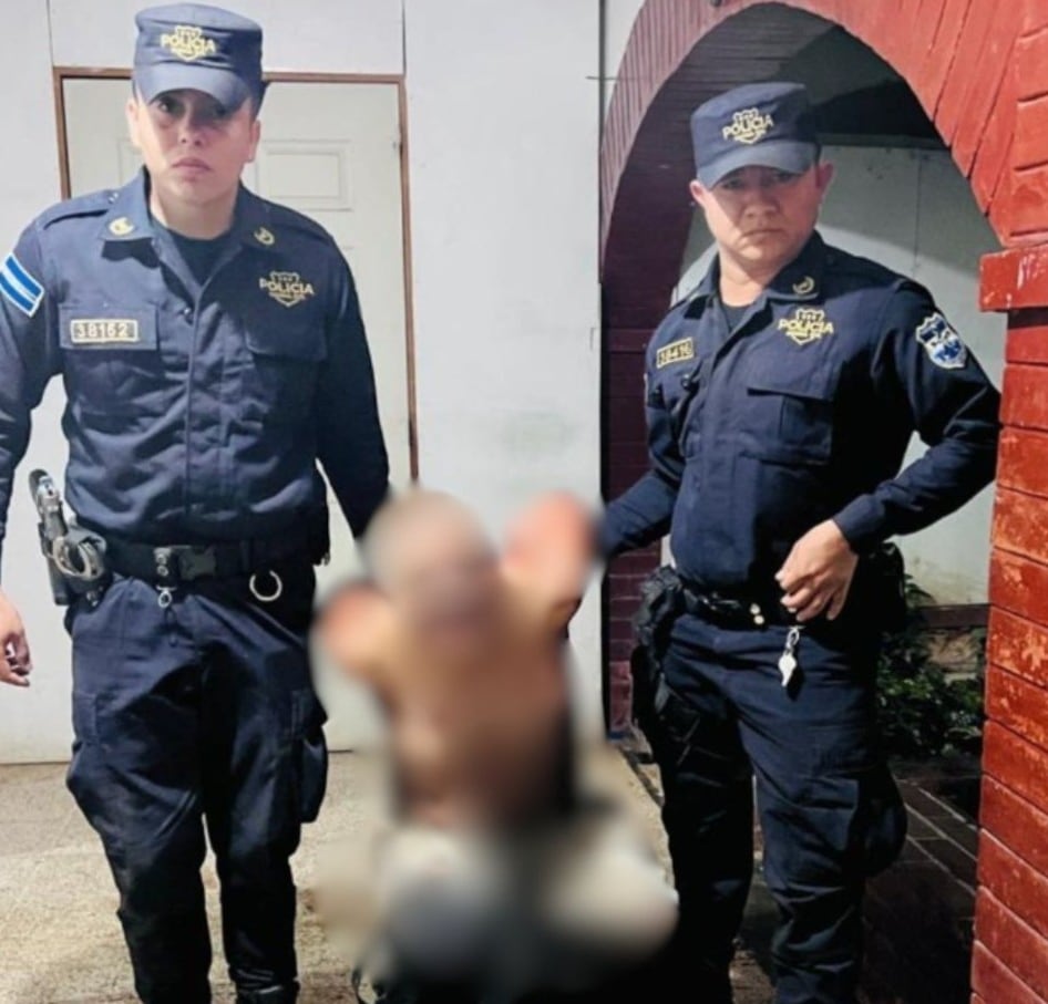 El hombre con antecedentes de trastornos mentales permanece bajo custodia policial mientras se esclarecen los hechos (Cortesía: PNC).