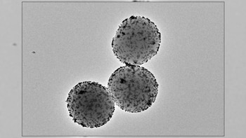 Imagen de microscopía electrónica de transmisión de los nanorobots (IRB Barcelona)