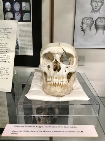 La barra de hierro que