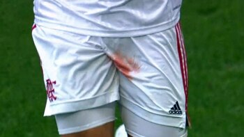 Gustavo Henrique abandonó el campo