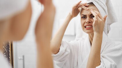 ¿Tienes brotes de acné inesperado? Estos son los 8 hábitos que podrían provocarlo