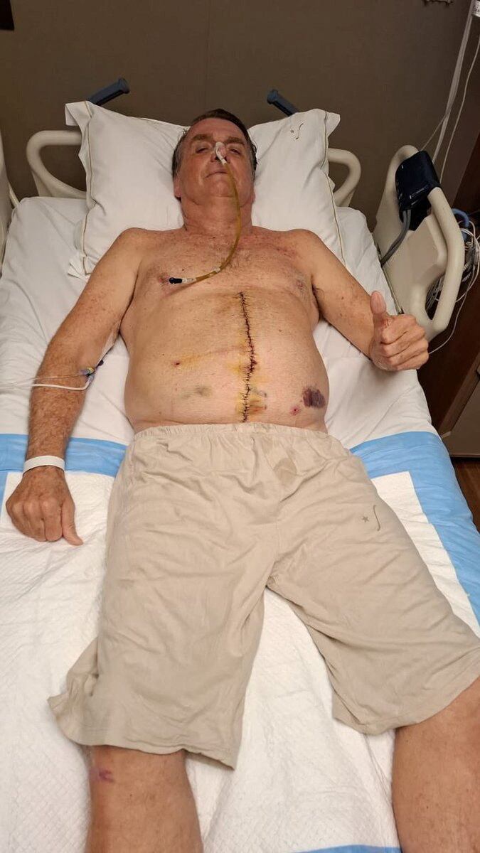 Jair Bolsonaro fue sometido a una operación intestinal (Jair Bolsonaro via X/Handout via REUTERS)