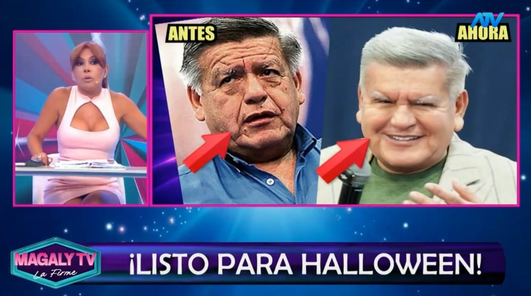¿Qué se habría hecho César Acuña en el rostro? Magaly Medina reacciona y especialistas analizan su apariencia. Captura: Magaly TV La Firme.