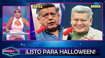 ¿Qué se habría hecho César Acuña en el rostro? Magaly Medina reacciona y especialistas analizan su apariencia. Captura: Magaly TV La Firme.