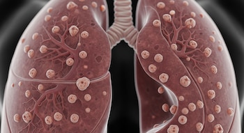 Imagen generada digitalmente que muestra