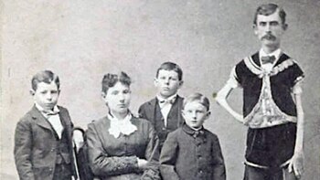 La trágica historia de “Esqueleto