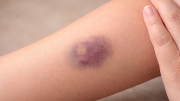 Por qué la aparición frecuente