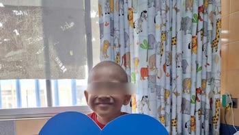 Médicos salvan a niño con cáncer tras extirparle tumor maligno y parte de su hígado - Créditos: Essalud.