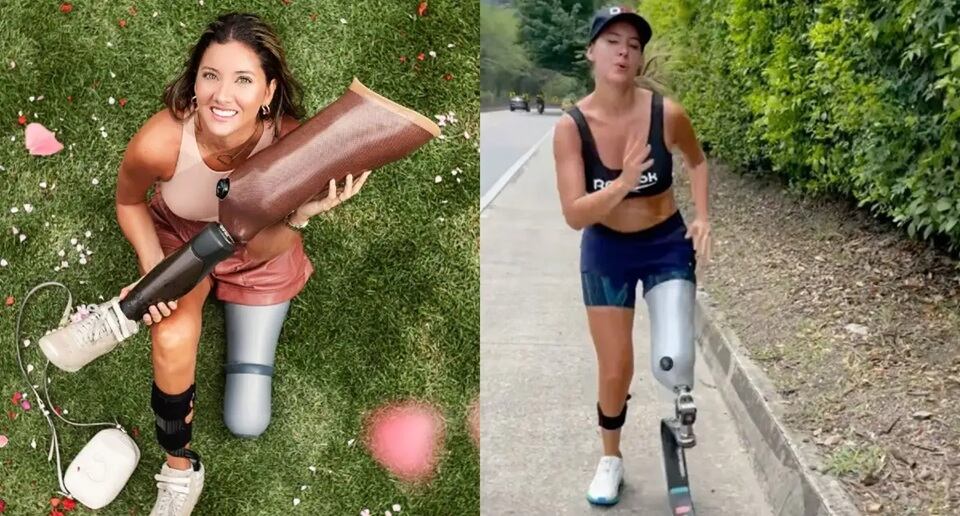 La modelo colombiana Daniela Álvarez compartió su experiencia sobre la importancia del apoyo familiar y la solidaridad ante la adversidad.