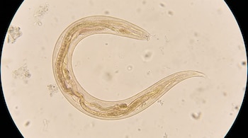 Imagen de microscopía de un nematodo Enterobius vermicularis adulto, con un cuerpo alargado, curvo y translúcido, sobre un fondo claro y granulado.