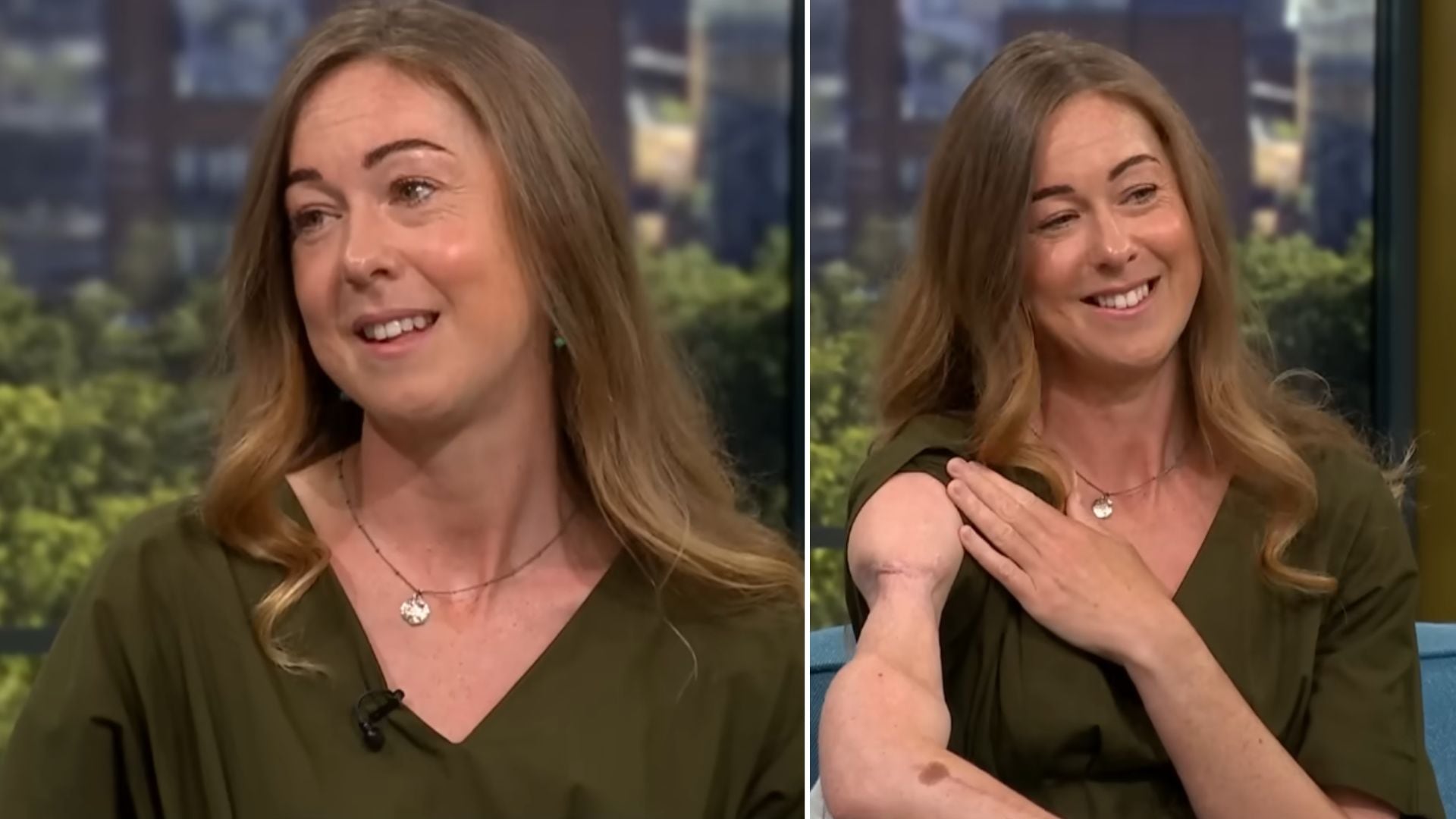 El brutal ataque de un tiburón que casi le cuesta el brazo: así fue la lucha por sobrevivir de Helen Fairlamb