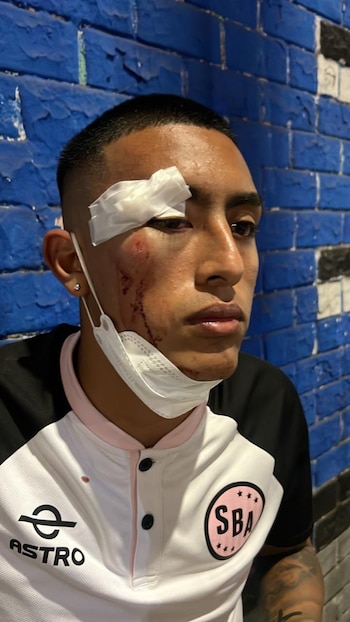 Fabrizio Roca fue atendido y