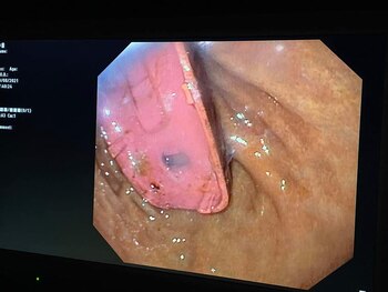 Vista del estómago del hombre