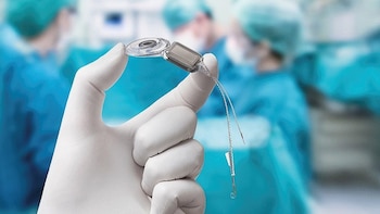 El implante coclear antes del año de vida mejora el desarrollo del lenguaje, según un estudio