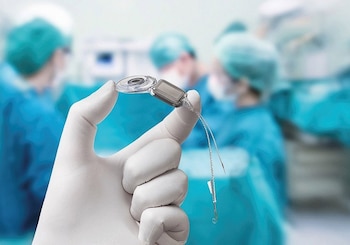 24/10/2016 Imagen de recurso de un implante coclear.
ESPAÑA EUROPA MADRID SALUD
COMSALUD