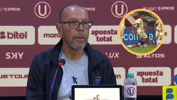 DT de Comerciantes Unidos calificó de “desleal” el pisotón de Alex Valera sobre Alexis Cossio en empate ante Universitario: “Casi le parte la pierna”