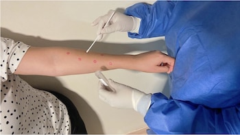 Imagen de un paciente con