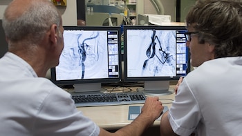 Un estudio de un hospital de Barcelona demuestra que administrar un fármaco tras la trombectomía mejora la recuperación del ictus grave
