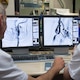 Un estudio de un hospital de Barcelona demuestra que administrar un fármaco tras la trombectomía mejora la recuperación del ictus grave