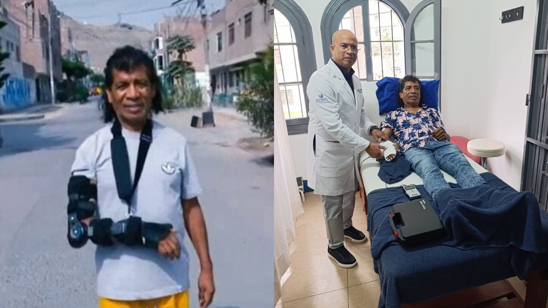 El comediante Cachay, conocido por su trayectoria circense, se recupera tras una cirugía en la mano, la cual pudo costear vendiendo su carpa de circo, según sus declaraciones.